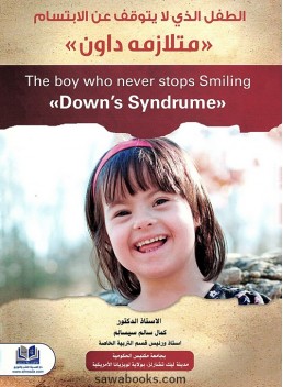 Down Syndrome: the child who never stops smiling
